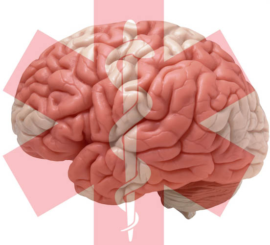 brain1 med symbol good