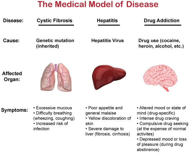 Disease-Model