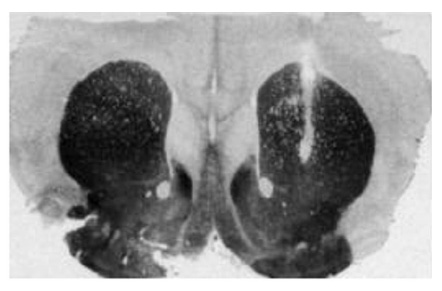 Evidence of probe placement in the Caudate  Putamen. (Zhang Y et al. Brain Res. 2001.)